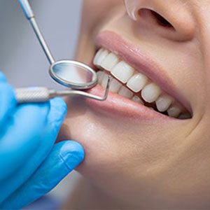 Warren C. Baine, D.M.D. | Implant Dentistry, Pocket Reduction Surgery and Bone Grafting and Guided Tissue Regeneration